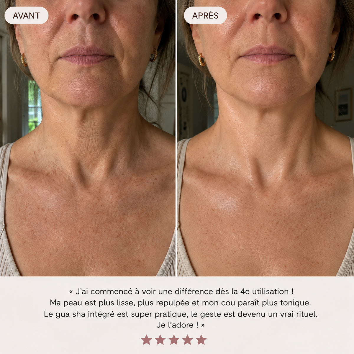 Crème Cou & Décolleté PDRN + Collagène avec Gua Sha – Roselin