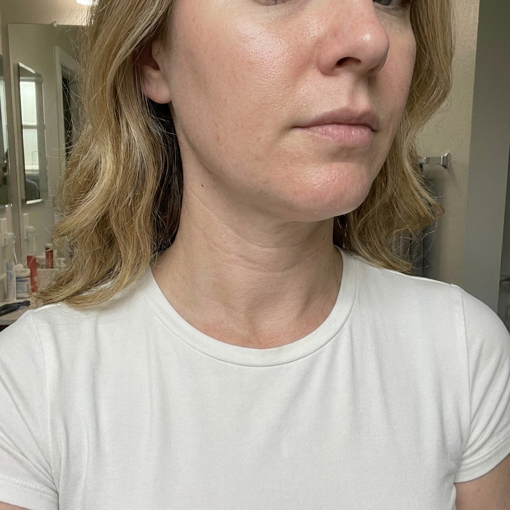 Jour 28, Manon, 41 ans
