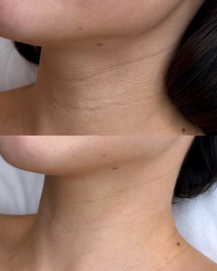 Crème Cou & Décolleté PDRN + Collagène avec Gua Sha – Roselin